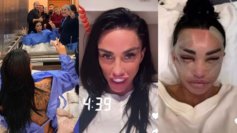 U Katie Price bez zmian. Pokazała twarz całą w opatrunkach, relacjonując kolejną operację w tureckiej klinice