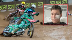 Żużel. Jason Doyle zabrał głos po upadku w Warszawie. Pokazał, jak wygląda po groźnej kraksie