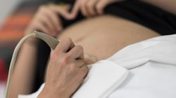 Zawał łożyska - przyczyny, objawy, diagnostyka i leczenie