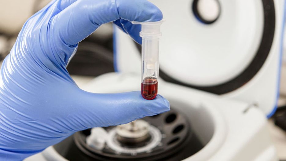 Badanie krwi w laboratorium