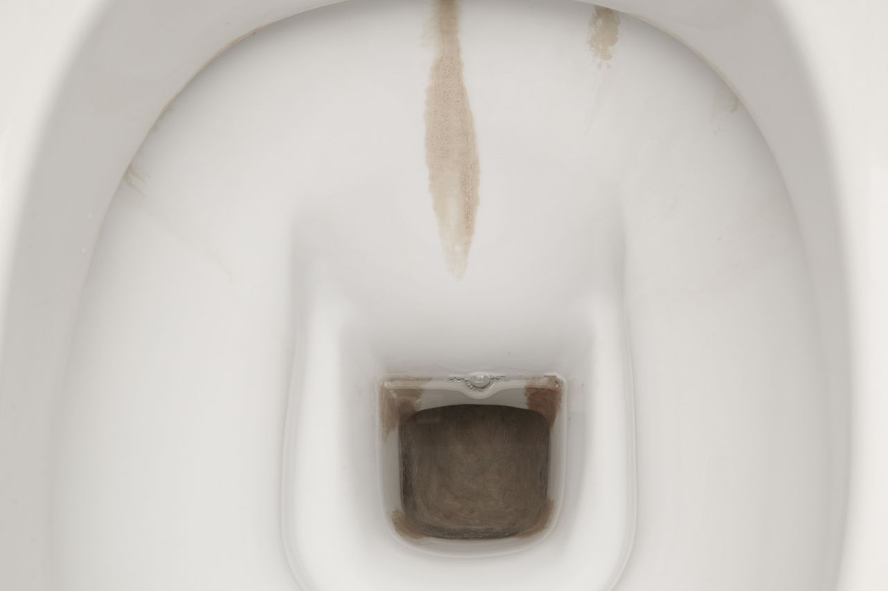 Dealing with stubborn toilet limescale: The overlooked flush leak and the vinegar solution