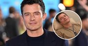 Orlando Bloom miał poważny zabieg usuwania mikroplastiku z ciała. Zapłacił fortunę