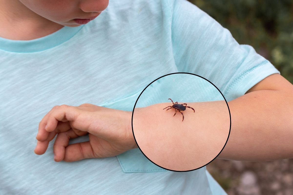 How to deal with ticks?