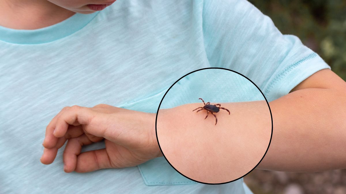 Jak radzić sobie z kleszczami?