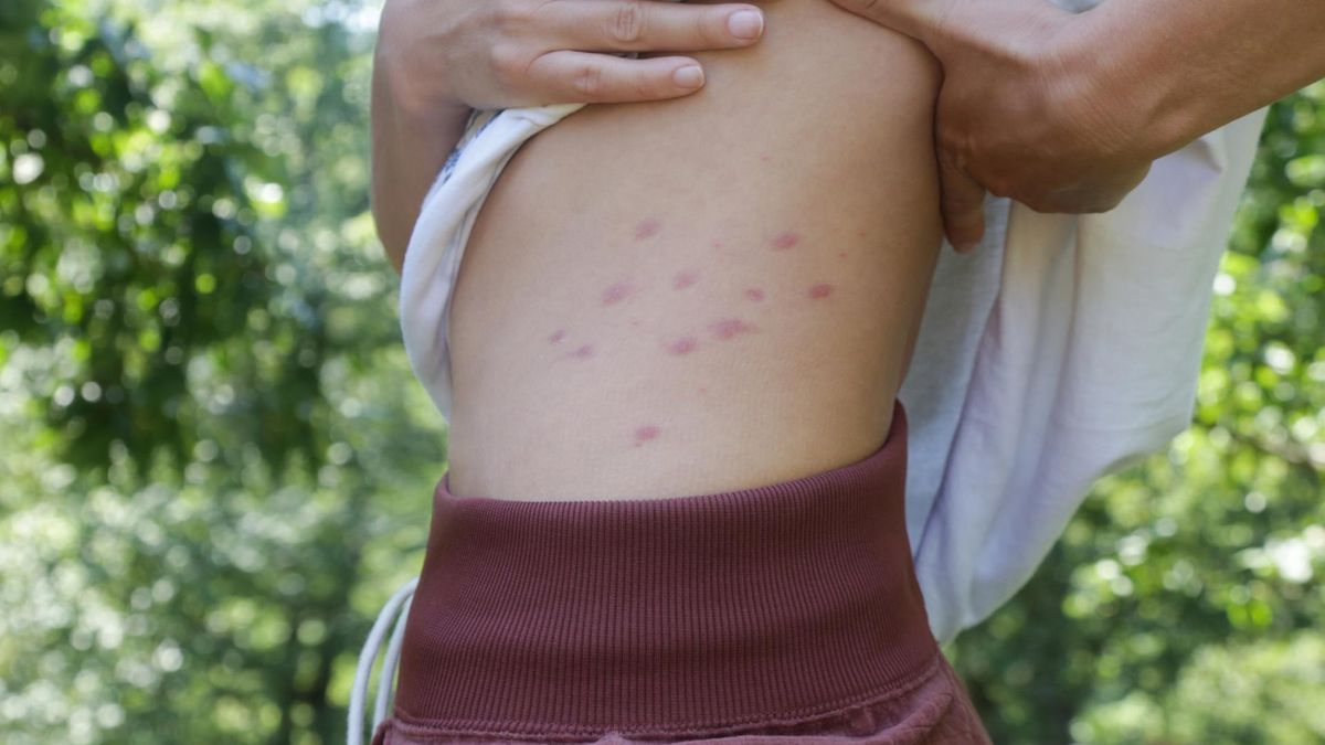 Trzustka wysyła sygnały na skórze. Nie lekceważ tych objawów