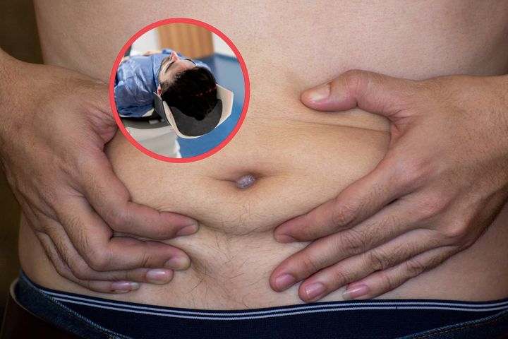 Tłuszcz trzewny może odgrywać kluczową rolę w rozwoju tej poważnej choroby