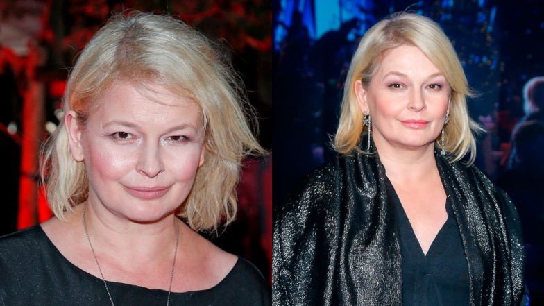 Te gwiazdy pożałowały operacji plastycznych