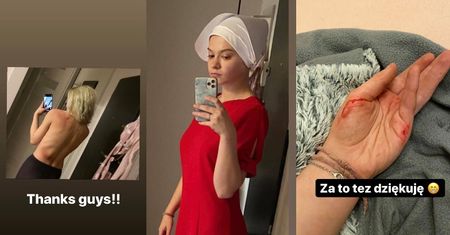 Julia Wróblewska pokazuje obrażenia po proteście w Warszawie: "Nikt nie ma prawa nas atakować!" (FOTO)