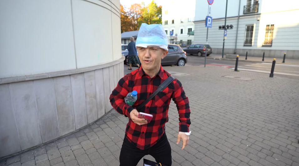 Mini Majk przeszczepił sobie włosy