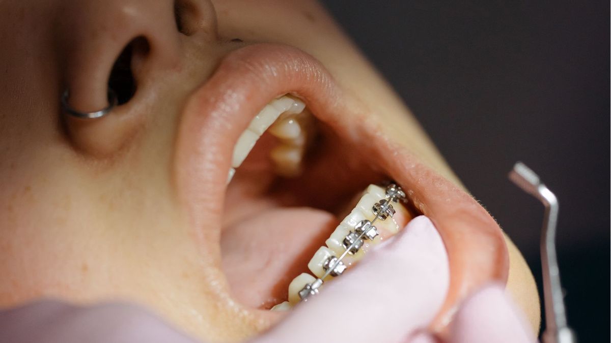 Terminy do ortodonty w Polsce