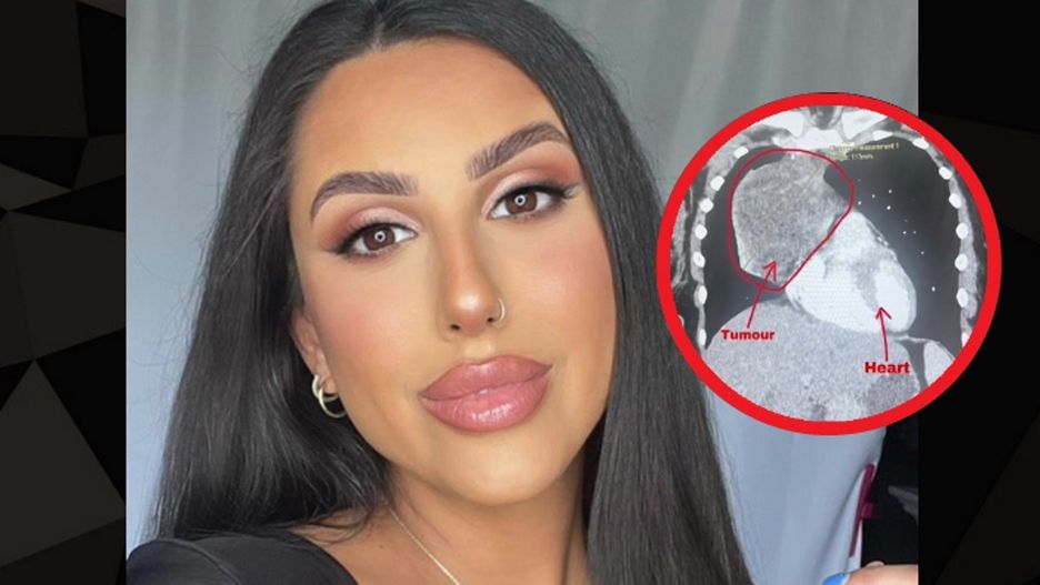 Po badaniach 12 razy dzwonili ze szpitala. To odkryli w jej ciele