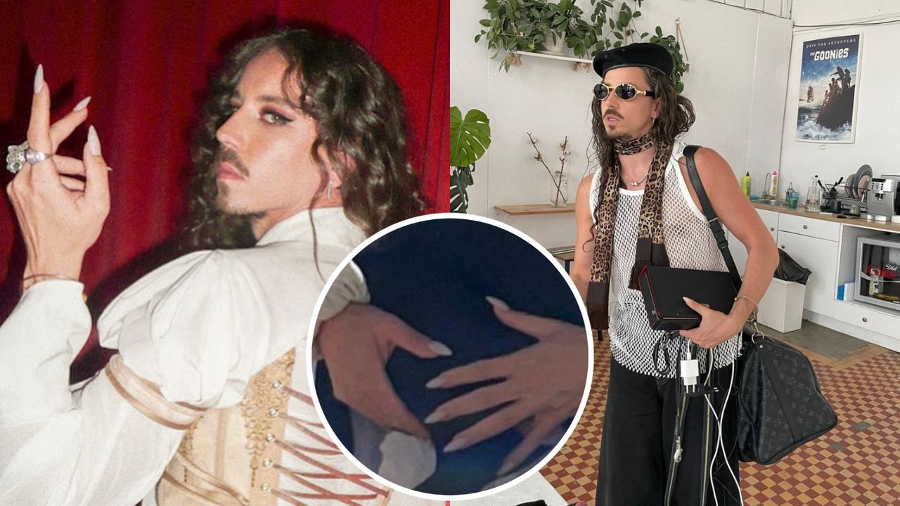 Michał Szpak konkretnie się ZAPUŚCIŁ? Ekspertka dała jasny komentarz w sprawie jego paznokci