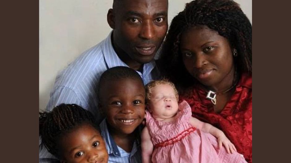 Nigeryjskiej parze urodziło się białe dziecko