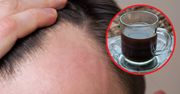 Popularny napój zwiększa ryzyko wypadania włosów. Zwłaszcza u mężczyn