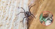 Bakteria "pożera jej ciało". Walczy o życie po pogryzieniu przez pająki