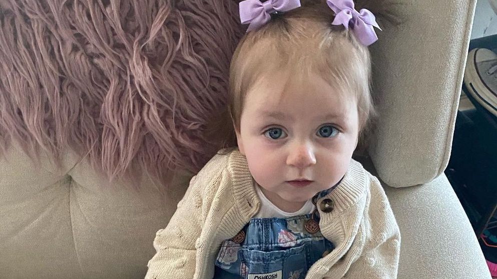 Dziewczynka urodziła się z nietypowym znamieniem 