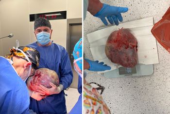 W Lesznie lekarze usunęli 11-kilogramowy guz. "Wymagający zabieg"