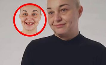 "Czyściła" zęby frezarką. Tak wygląda po metamorfozie