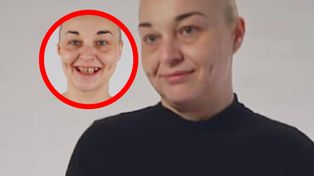"Czyściła" zęby frezarką. Tak wygląda po metamorfozie