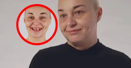 "Czyściła" zęby frezarką. Tak wygląda po metamorfozie