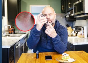 Znak, że trzustka ma kłopot. Tak zaczyna się cukrzyca