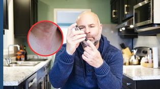 Znak, że trzustka ma kłopot. Tak zaczyna się cukrzyca