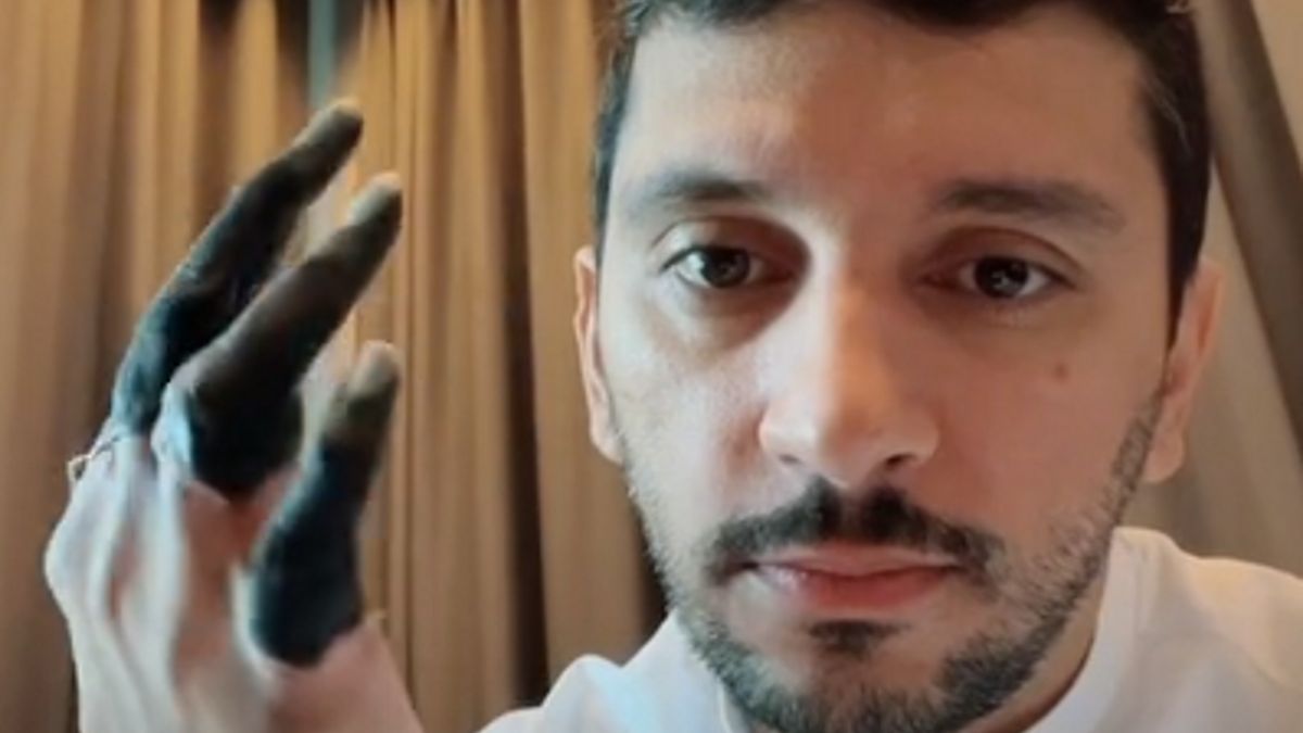 Fahad Badar stracił palce
