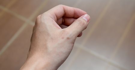 Palec spustowy. Znak, że cukrzyca już zaatakowała