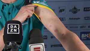 Skandal po rundzie MŚ w Brazylii. Zawodnicy pokazali obrażenia