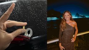 Siatkarka postrzelona. Kula przeszła 1 mm od kręgosłupa