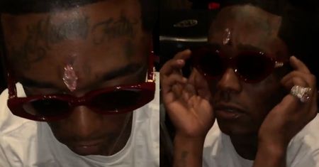 Raper Lil Uzi Vert wszczepił sobie w czoło diament wart 24 MILIONY DOLARÓW! Ładny? (FOTO)