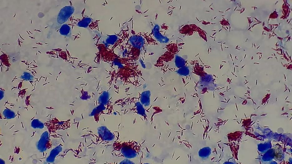 Mycobacterium leprae