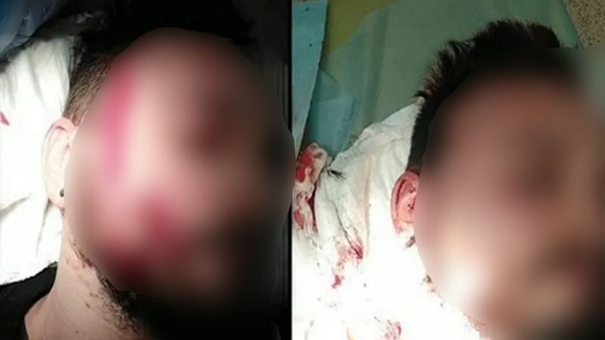 Twarz mężczyzny została rozcięta nożem