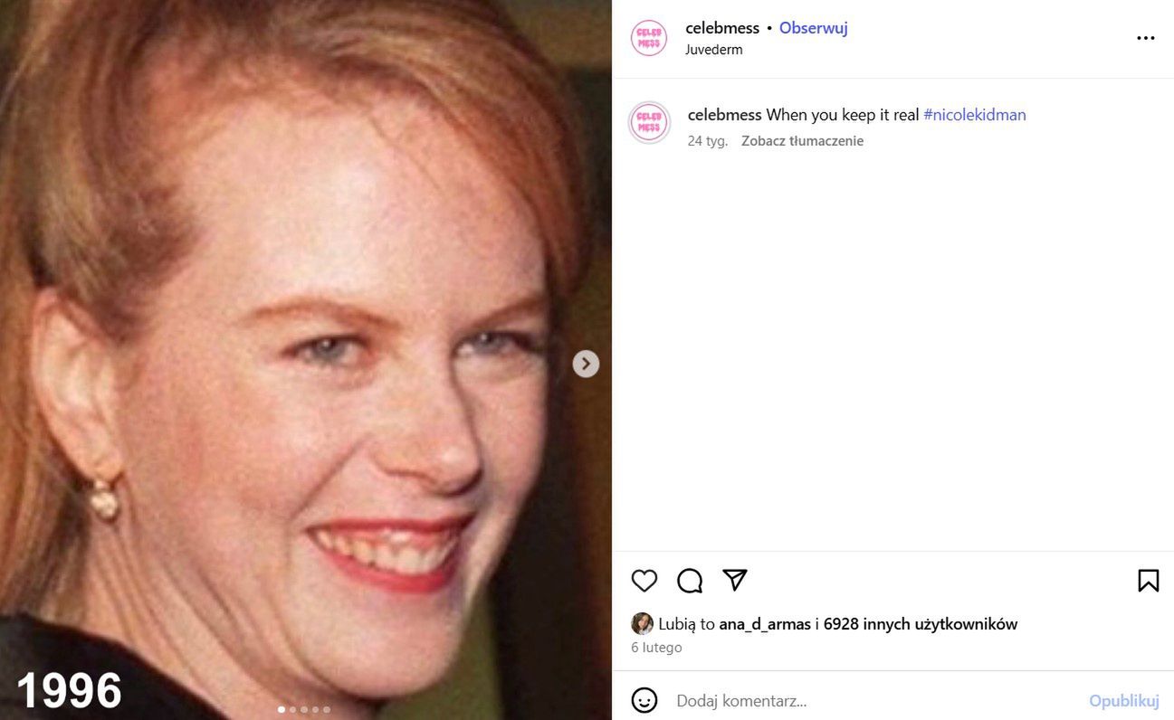 Nicole Kidman