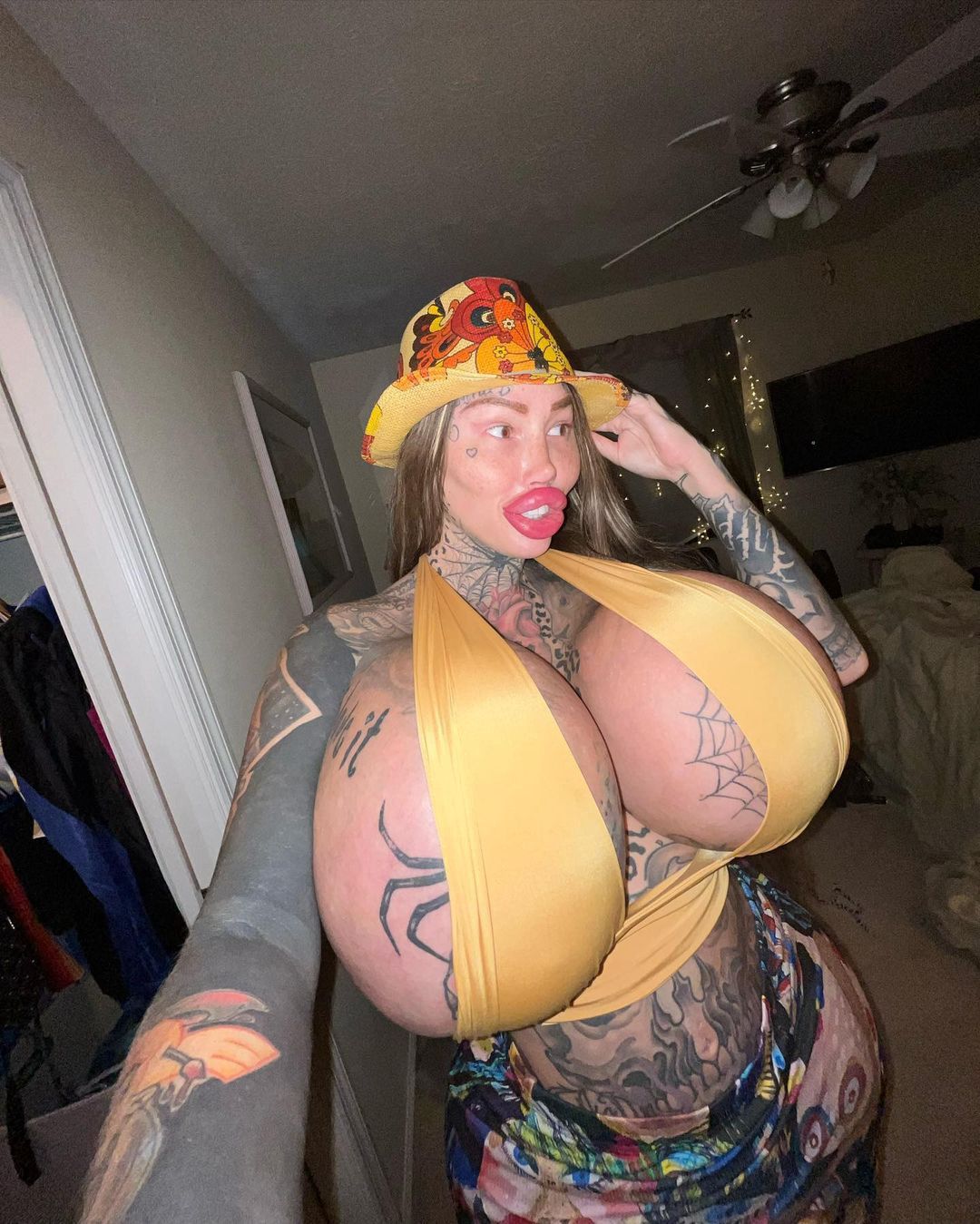 Instagramowej modelce wybuchł implant piersi. Ważył 10 kg