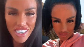 Katie Price LEDWO porusza twarzą. Właśnie zapowiedziała kolejną operację: "Chcę, żeby wyglądał jak nadmuchiwany balon"