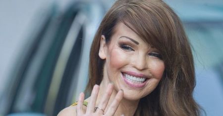Katie Piper: Jeszcze nigdy nie była tak szczęśliwa! Odzyskała twarz i radość życia