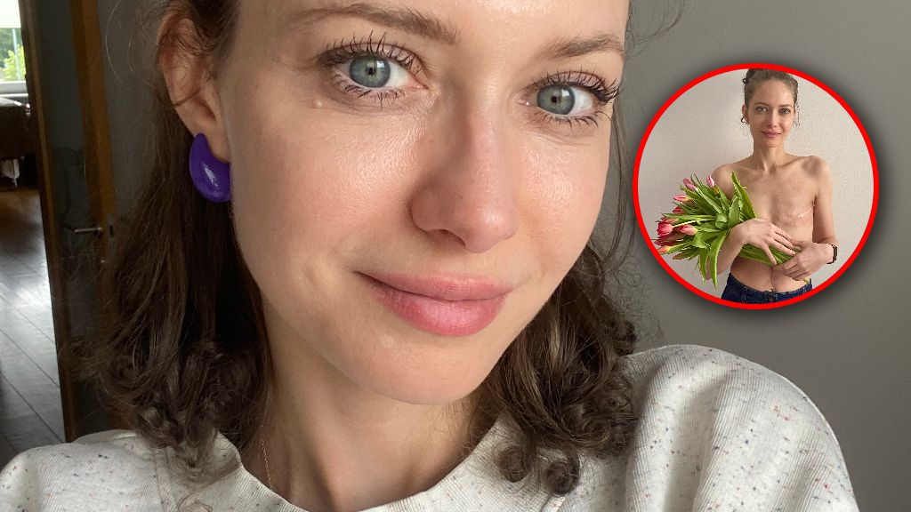 "Na diagnostyce straciłam siedem miesięcy"