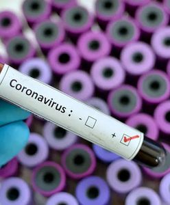 Das Coronavirus - die Landkarte. Polen und die Welt