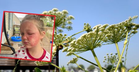 Jedna z najbardziej trujących roślin w Polsce. 6-latka znalazła ją w ogrodzie