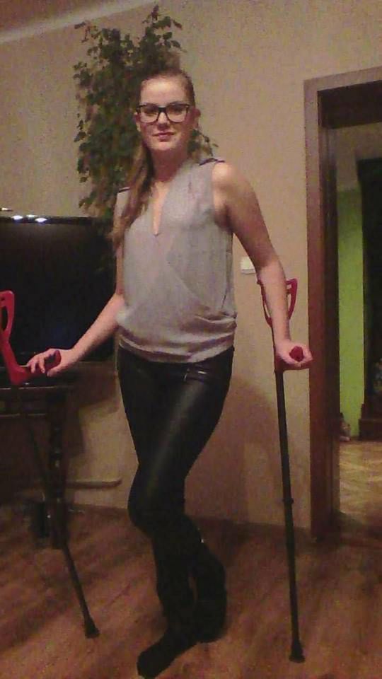 Zdjęcie kilka miesięcy po wymianie stawu biodrowego