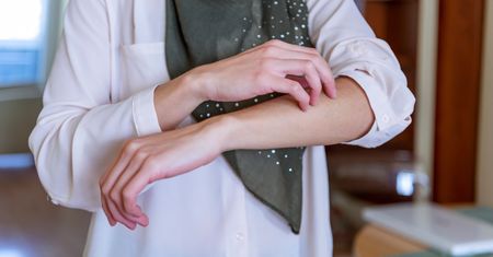 "Skóra kurczaka". Sprawdź, jak radzić sobie z nieestetycznymi krostkami