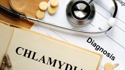 Chlamydia trachomatis i pneumoniae - objawy, diagnostyka, leczenie