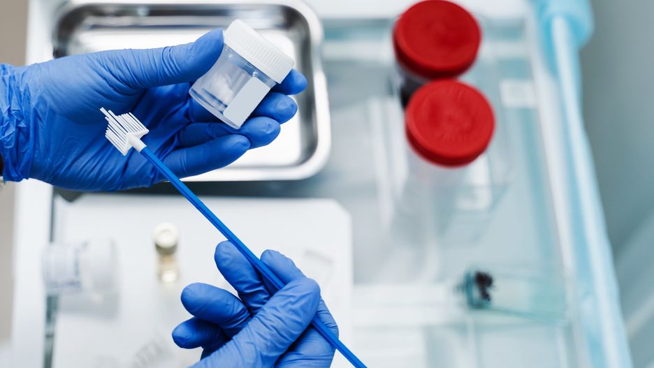 Gynecological cytology Pap smear test and cytobrush in hands of gynecologist. Gynecologist is holding flask for cytology Pap smear test in hands.
Gynecological cytology Pap smear test and cytobrush in hands of gynecologist. Gynecologist is holding flask for cytology Pap smear test in hands
pap, smear, cytology, gynecology, cytobrush, flask, gynecologist, test, pap smear, hpv, medical, patient, doctor, cervix, liquid, gynecological, medicine, health, female, hospital, cervical, woman, hpv virus, conventional, protection, woman health, equipment, prevention, disease, laboratory, cervical cancer, clinic, papanicolaou, papilloma, lab, papillomavirus, exam, cancer, nurse, biology, analysis, research, scientist, virus, tests, inspect, consultation, smears, pap, smear, cytology, gynecology, cytobrush, flask, gynecologist, test, pap smear, hpv, medical, patient, doctor, cervix, liquid, gynecological, medicine, health, female, hospital, cervical, woman, hpv virus, conventional, protection, woman health, equipment, prevention, disease, laboratory, cervical cancer, clinic, papanicolaou, papilloma, lab, papillomavirus, exam, cancer, nurse, biology, analysis, research, scientist, virus, tests, inspect, consultation, smears