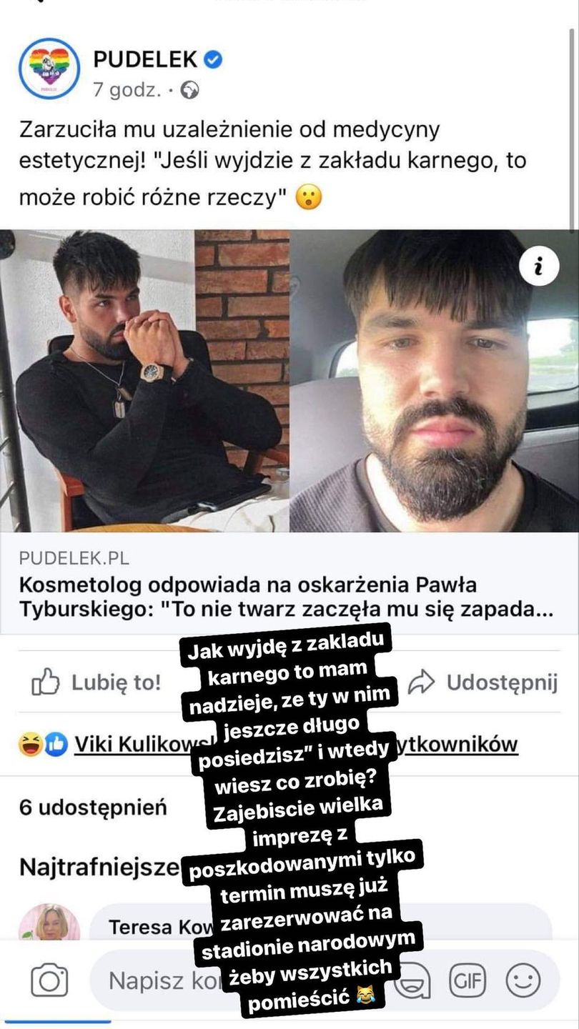 Paweł z "Love Island" odpowiada kosmetolog