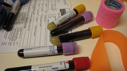 Błyskawiczny test do wykrywania wirusów Ebola 1