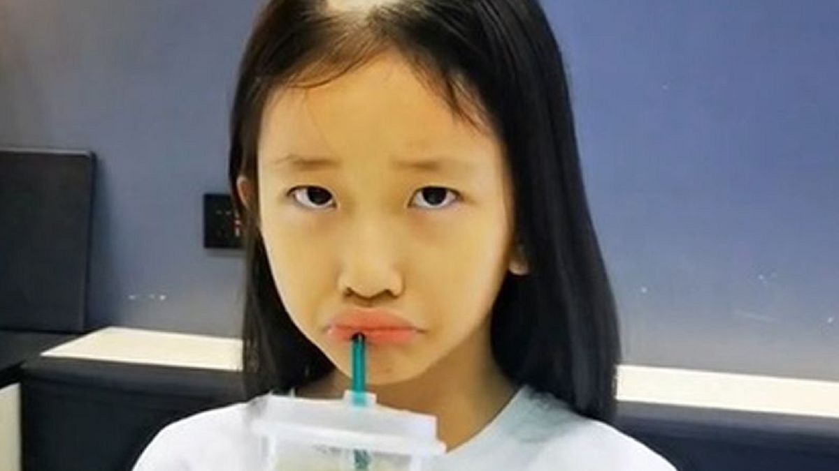 Dziewczynka nagle zaczęła tracić włosy.