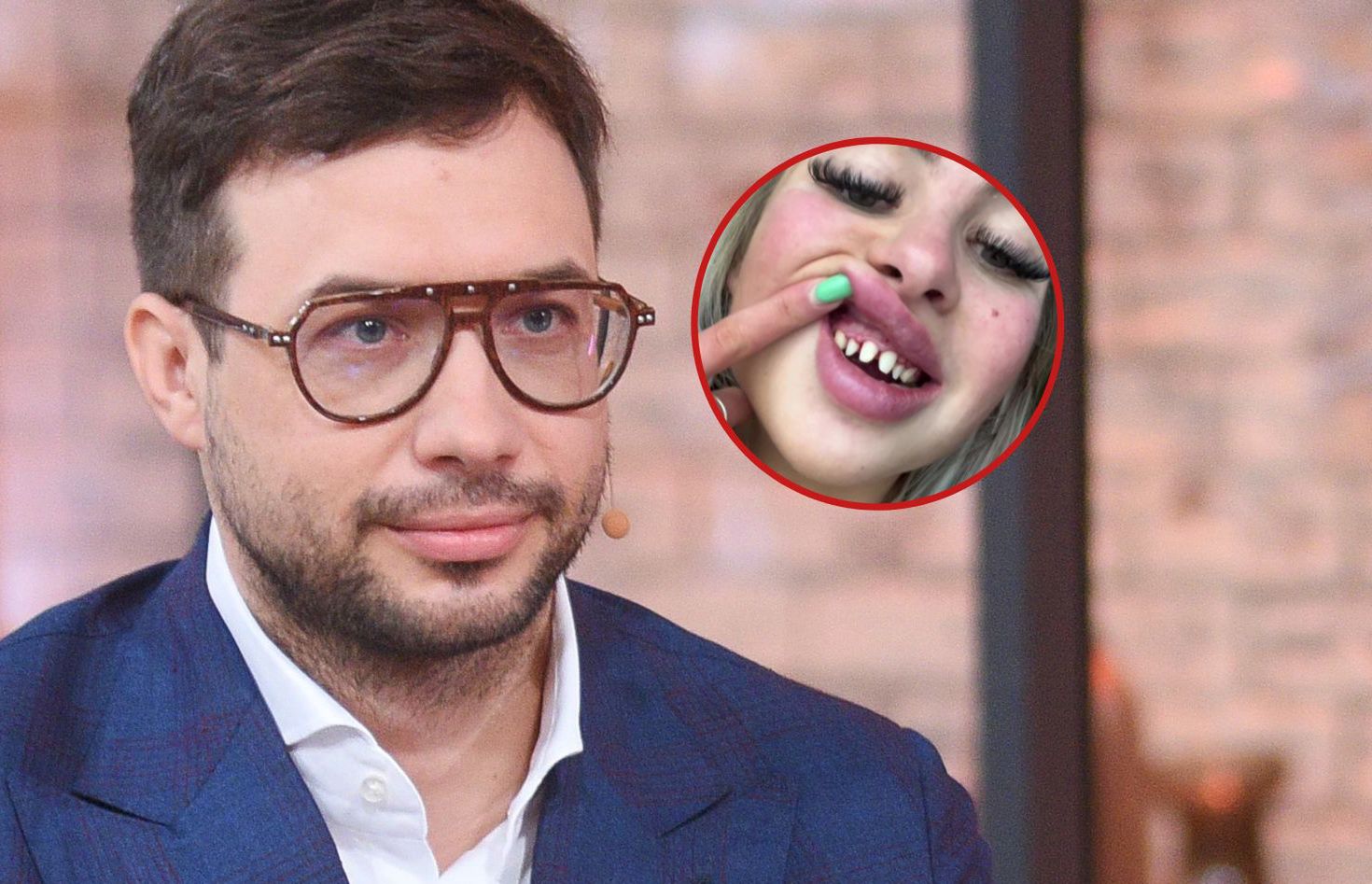 Los pacientes no saben nada.  Cirujano polaco con «dientes turcos» – o2