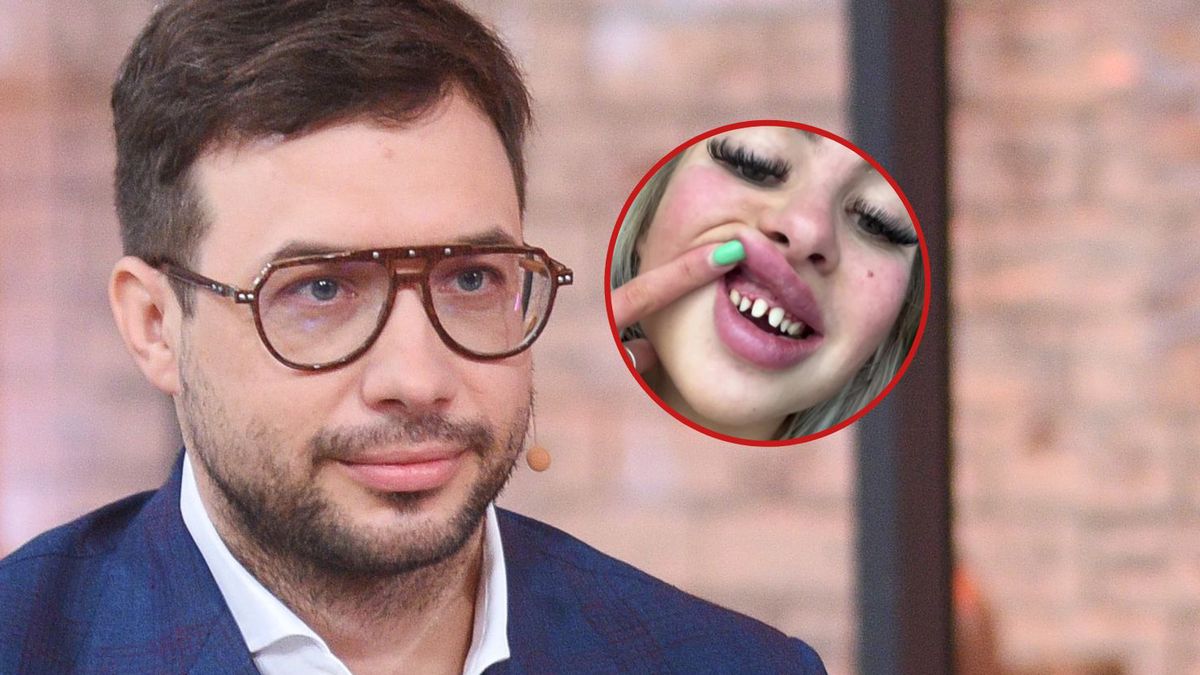 Chirurg przestrzega przed operacjami z zakresu medycyny estetycznej