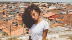 Melanina - rodzaje, funkcje, niedobór i nadmiar